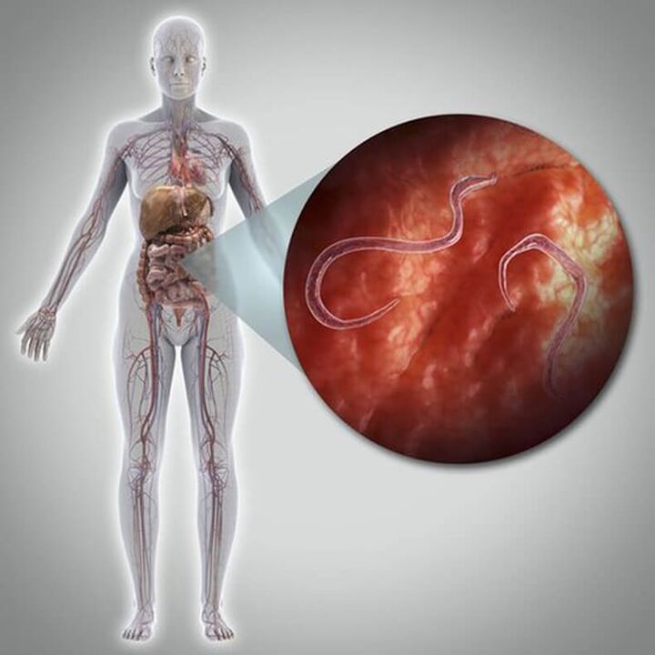 Parasit dalam badan seseorang
