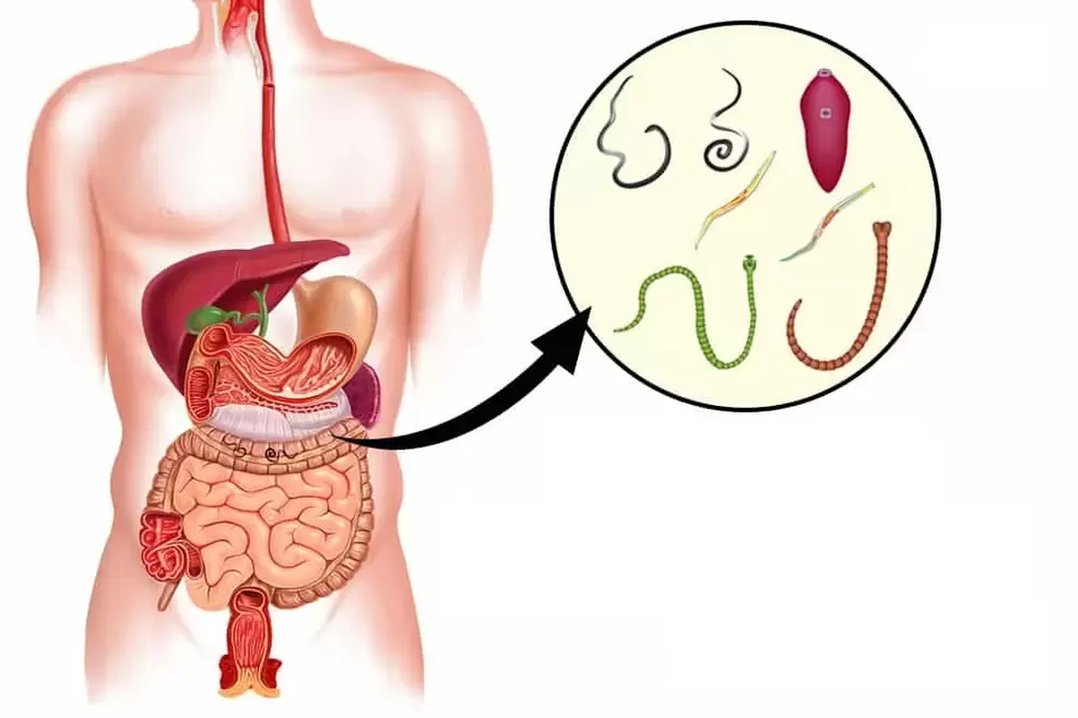Cacing dalam badan manusia