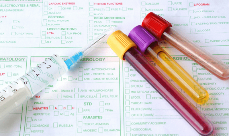 Pilihan diagnosis untuk parasit dalam badan