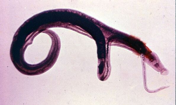 Skistosoma adalah antara parasit yang paling biasa dan berbahaya
